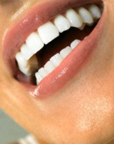 Beberapa Cara Menjaga Kesehatan Gigi Dan Mulut